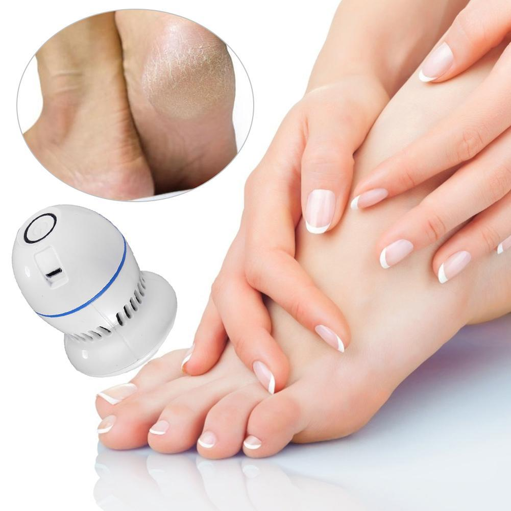 Lovely™ | Smart Callus Remover